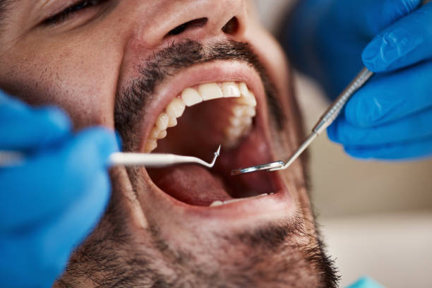 Best Urgent Dental Care  in Montalvin Manor, CA
