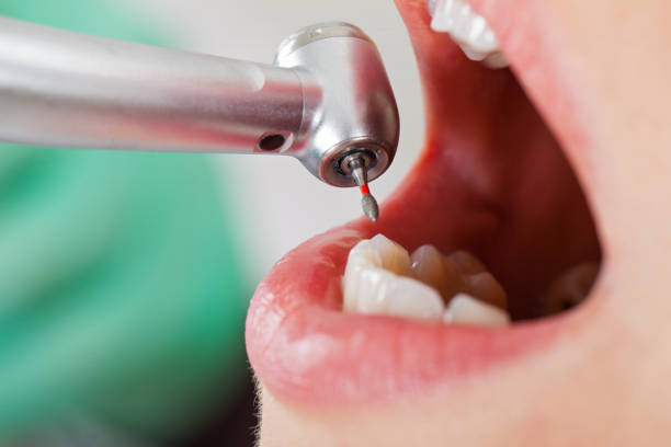 Best Emergency Dentist Near Me  in Montalvin Manor, CA
